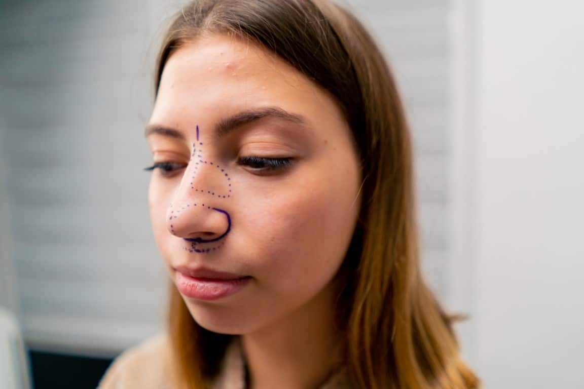 Septoplastyka – chirurgiczne skorygowanie krzywej przegrody nosowej